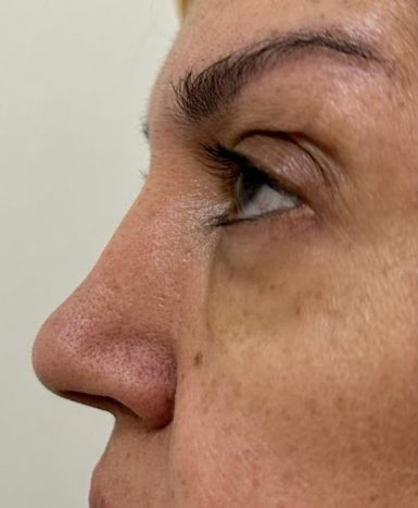 Antes da harmonização