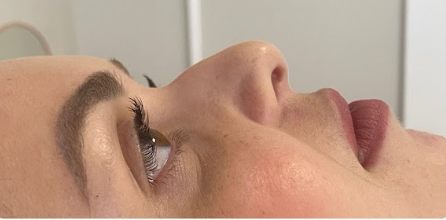 Antes da harmonização