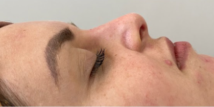 Depois da harmonização