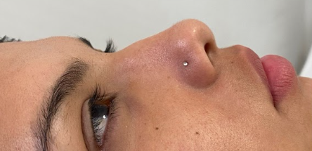 Antes da harmonização