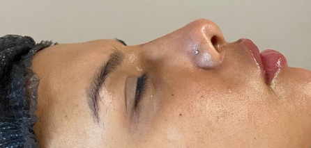 Depois da harmonização